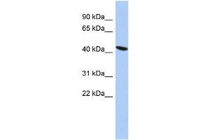 WB Suggested Anti-ZNF71 Antibody Titration: 1 ug/ml Positive Control: PANC1 cell lysate (ZNF71 抗体  (Middle Region))