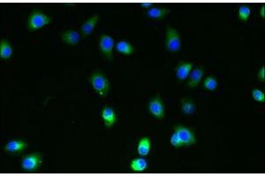 Immunofluorescent analysis of A2780 cells using ABIN7174666 at dilution of 1:100 and Alexa Fluor 488-congugated AffiniPure Goat Anti-Rabbit IgG(H+L) (SLC35B4 抗体  (AA 174-200))