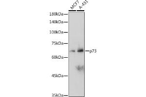 Western blot analysis of extracts of various cell lines, using p73 antibody (ABIN1678945, ABIN1678944, ABIN7101487 and ABIN7101488) at 1:1000 dilution. (Tumor Protein p73 抗体)