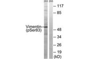 Western blot analysis of extracts from 293 cells treated with paclitaxel 1uM 24h, using Vimentin (Phospho-Ser83) Antibody. (Vimentin 抗体  (pSer83))