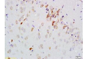 Formalin-fixed and paraffin embedded rat brain labeled with Anti-GDNF-Receptor-alpha-2 Polyclonal Antibody, Unconjugated 1:200 followed by conjugation to the secondary antibody and DAB staining (GFRA2 抗体  (AA 301-360))
