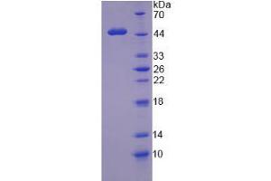 SDS-PAGE analysis of Human WT1 Protein. (WT1 蛋白)