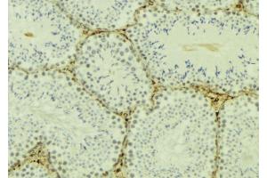 ABIN6277174 at 1/100 staining Mouse testis tissue by IHC-P. (TBP 抗体  (N-Term))
