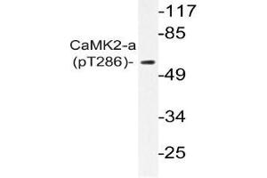 Western blot (WB) analysis of p-CaMK2-a antibody in extracts from A431 EGF cells (CAMK2A 抗体  (pThr286))