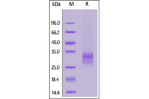 SDS-PAGE (SDS) image for Tumor Necrosis Factor (Ligand) Superfamily, Member 11 (TNFSF11) (AA 64-245) (Active) protein (His tag) (ABIN5674645)