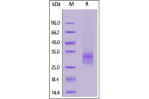 Human TNFSF11, His Tag (active trimer) on  under reducing (R) condition. (RANKL Protein (AA 64-245) (His tag))