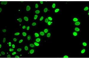 Immunofluorescence analysis of HeLa cells using SEPT7 Polyclonal Antibody (Septin 7 抗体)