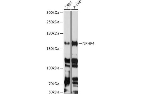NPHP4 抗体  (AA 1247-1426)