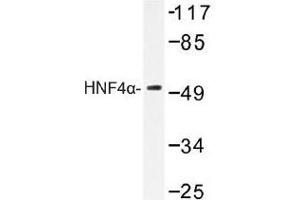 Image no. 1 for anti-Hepatocyte Nuclear Factor 4, alpha (HNF4A) antibody (ABIN317780) (HNF4A 抗体)