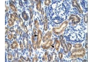 Image no. 1 for anti-Hematopoietic Cell-Specific Lyn Substrate 1 (HCLS1) (AA 28-77) antibody (ABIN202645) (HCLS1 抗体  (AA 28-77))