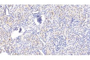 Immunohistochemistry (IHC) image for anti-Tensin 1 (TNS1) (AA 4-307) antibody (ABIN7444820)