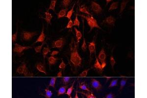 Immunofluorescence analysis of C6 cells using UCP3 Polyclonal Antibody at dilution of 1:100. (UCP3 抗体)