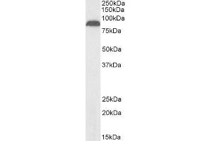 Biotinylated ABIN5539600 (2µg/ml) staining of Human Pancreas lysate (35µg protein in RIPA buffer), exactly mirroring its parental non-biotinylated product. (TRPV5 抗体  (Internal Region) (Biotin))