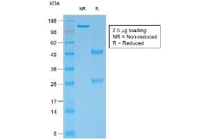 SDS-PAGE Analysis of Purified BCL2 Mouse Recombinant Monoclonal Antibody ABIN6383841. (Recombinant Bcl-2 抗体)