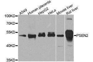 Western blot analysis of extracts of various cell lines, using PSEN2 antibody. (Presenilin 2 抗体)