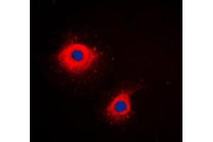 Immunofluorescent analysis of Cytokeratin 7 staining in HeLa cells. (Cytokeratin 7 抗体  (C-Term))