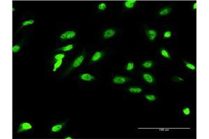 Immunofluorescence (IF) image for anti-Zic Family Member 4 (ZIC4) (AA 1-90) antibody (ABIN1327198)
