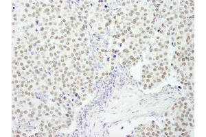 Immunohistochemistry (IHC) image for anti-REST Corepressor 3 (RCOR3) (AA 445-495) antibody (ABIN7449047)