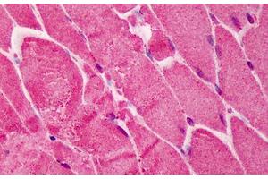 Human Skeletal Muscle: Formalin-Fixed, Paraffin-Embedded (FFPE) (RNF2 抗体  (AA 189-201))