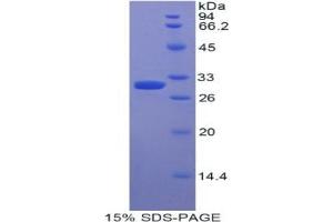 SDS-PAGE analysis of Human Myosin IE Protein.