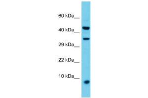 Host: Rabbit  Target Name: Vamp8  Sample Tissue: Rat Spleen lysates  Antibody Dilution: 1. (VAMP8 抗体  (Middle Region))