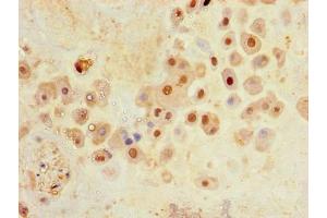 Immunohistochemistry of paraffin-embedded human placenta tissue using ABIN7176688 at dilution of 1:100 (SLC3A8 (AA 320-369) 抗体)