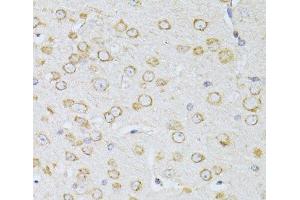 Immunohistochemistry of paraffin-embedded Mouse brain using NTS Polyclonal Antibody at dilution of 1:100 (40x lens). (Neurotensin 抗体)
