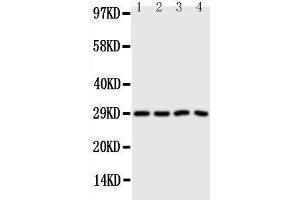 Anti-Carbonic Anhydrase III antibody, Western blotting Lane 1: SMMC Cell Lysate Lane 2: HELA Cell Lysate Lane 3: SW620 Cell Lysate Lane 4: SCG Cell Lysate (CA3 抗体  (N-Term))