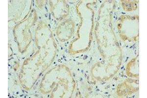 Immunohistochemistry (IHC) image for anti-Solute Carrier Family 39 (Zinc Transporter), Member 6 (SLC39A6) (AA 170-320) antibody (ABIN7176712)