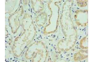 Immunohistochemistry of paraffin-embedded human kidney tissue using ABIN7176712 at dilution of 1:100 (SLC39A6 抗体  (AA 170-320))