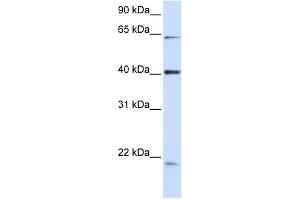 C19ORF46 antibody used at 1 ug/ml to detect target protein. (C19orf46 抗体  (N-Term))