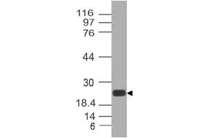 Image no. 1 for anti-C-Type Lectin Domain Family 4, Member E (CLEC4E) antibody (ABIN5026978) (CLEC4E 抗体)