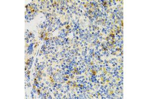 Immunohistochemistry of paraffin-embedded mouse spleen using SH2B1 Antibody (ABIN1876744) at dilution of 1:100 (40x lens). (SH2B1 抗体)