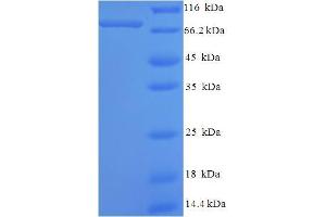 SDS-PAGE (SDS) image for PC4 and SFRS1 Interacting Protein 1 (PSIP1) (AA 1-530), (full length) protein (His-SUMO Tag) (ABIN5710167)