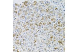 Immunohistochemistry of paraffin-embedded mouse stomach using HPS1 antibody (ABIN5973982) at dilution of 1/100 (40x lens). (HPS1 抗体)