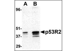 Western blot analysis of p53R2 expression in A431 cell lysate with this product at (A) 0. (RRM2B 抗体  (N-Term))