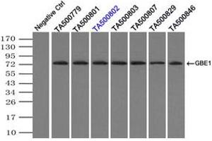 Image no. 4 for anti-Glucan (1,4-alpha-), Branching Enzyme 1 (GBE1) antibody (ABIN1498396)