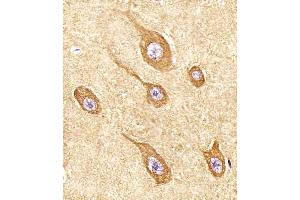 (ABIN6243304 and ABIN6577970) staining STMN2 in Human brain tissue sections by Immunohistochemistry (IHC-P - paraformaldehyde-fixed, paraffin-embedded sections).