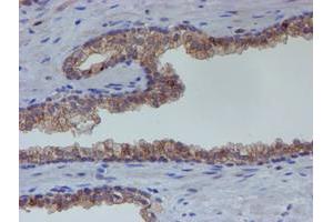 Image no. 1 for anti-Estrogen Receptor 1 (ESR1) antibody (ABIN1498060) (Estrogen Receptor alpha 抗体)