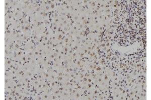ABIN6273567 at 1/100 staining Human liver tissue by IHC-P. (ZNF709 抗体  (N-Term))
