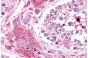 Immunohistochemistry (Paraffin-embedded Sections) (IHC (p)) image for anti-Calcium Channel, Voltage-Dependent, beta 2 Subunit (CACNB2) (N-Term) antibody (ABIN6736360)