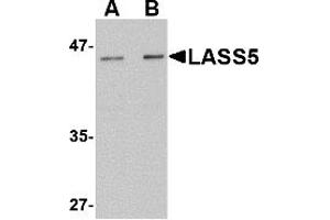 Western Blotting (WB) image for anti-LAG1 Homolog, Ceramide Synthase 5 (LASS5) (N-Term) antibody (ABIN1031436) (LASS5 抗体  (N-Term))