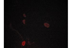 ABIN6269260 staining lovo cells by ICC/IF. (JNK 抗体)