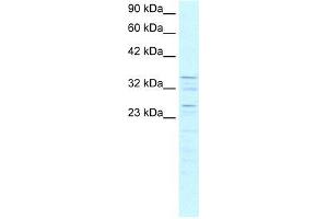 Human K562; WB Suggested Anti-ZNF385 Antibody Titration: 0. (ZNF385A 抗体  (C-Term))