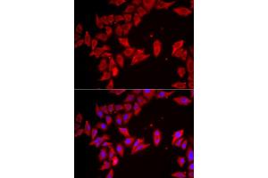 Immunofluorescence analysis of HeLa cell using SLC35A2 antibody. (SLC35A2 抗体)
