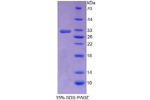 SDS-PAGE analysis of Human SHP Protein. (NR0B2 蛋白)