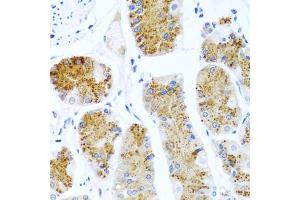 Immunohistochemistry of paraffin-embedded human stomach using C8orf4 antibody (ABIN5975014) at dilution of 1/100 (40x lens). (C8orf4 抗体)
