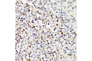 Immunohistochemistry of paraffin-embedded human spleen using CD5 Rabbit mAb (ABIN7266206) at dilution of 1:100 (40x lens).