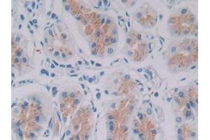 Detection of GDF6 in Human Stomach Tissue using Polyclonal Antibody to Growth Differentiation Factor 6 (GDF6) (GDF6 抗体  (AA 336-455))