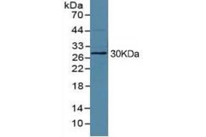 Western Blotting (WB) image for High Mobility Group Box 1 (HMGB1) ELISA Kit (ABIN6574155)